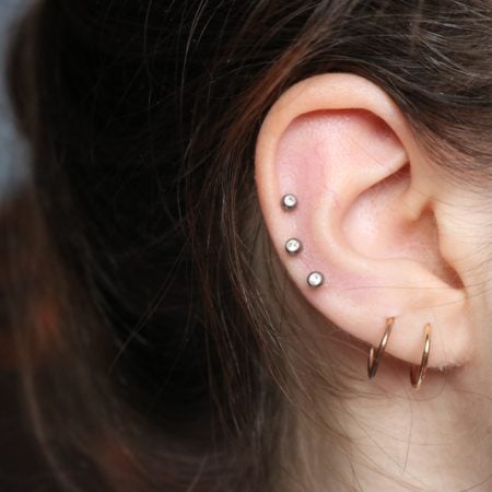 How to Manage Piercing Keloids