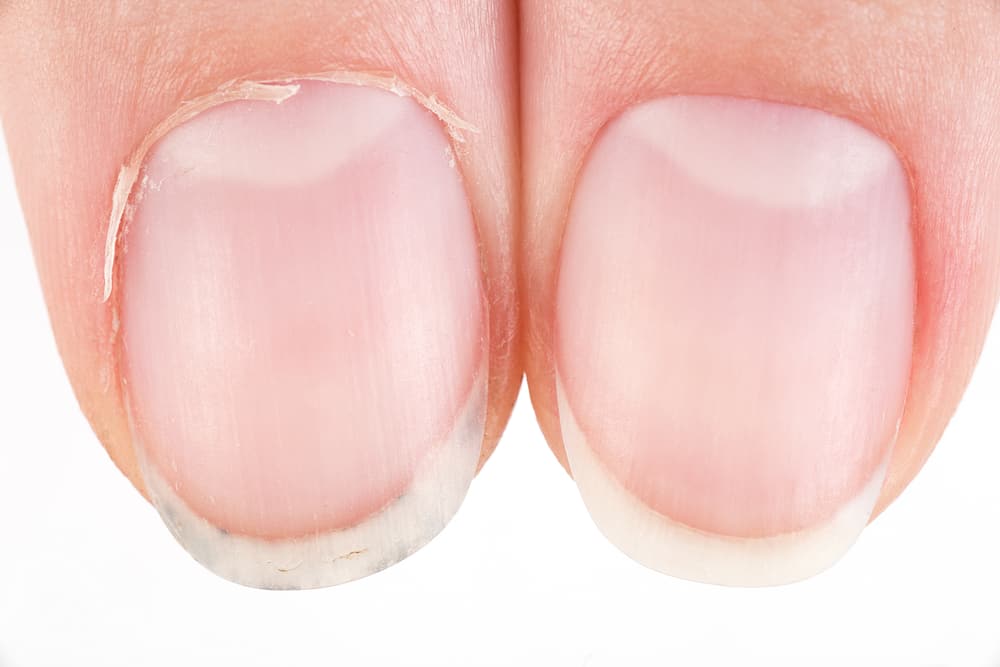 The 10 Best Cuticle Removers to Buy in 2024 Beauty Mag