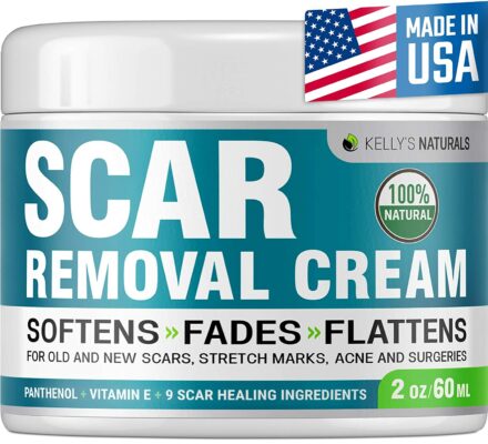 Kelly's Naturals Scar Removal Cream