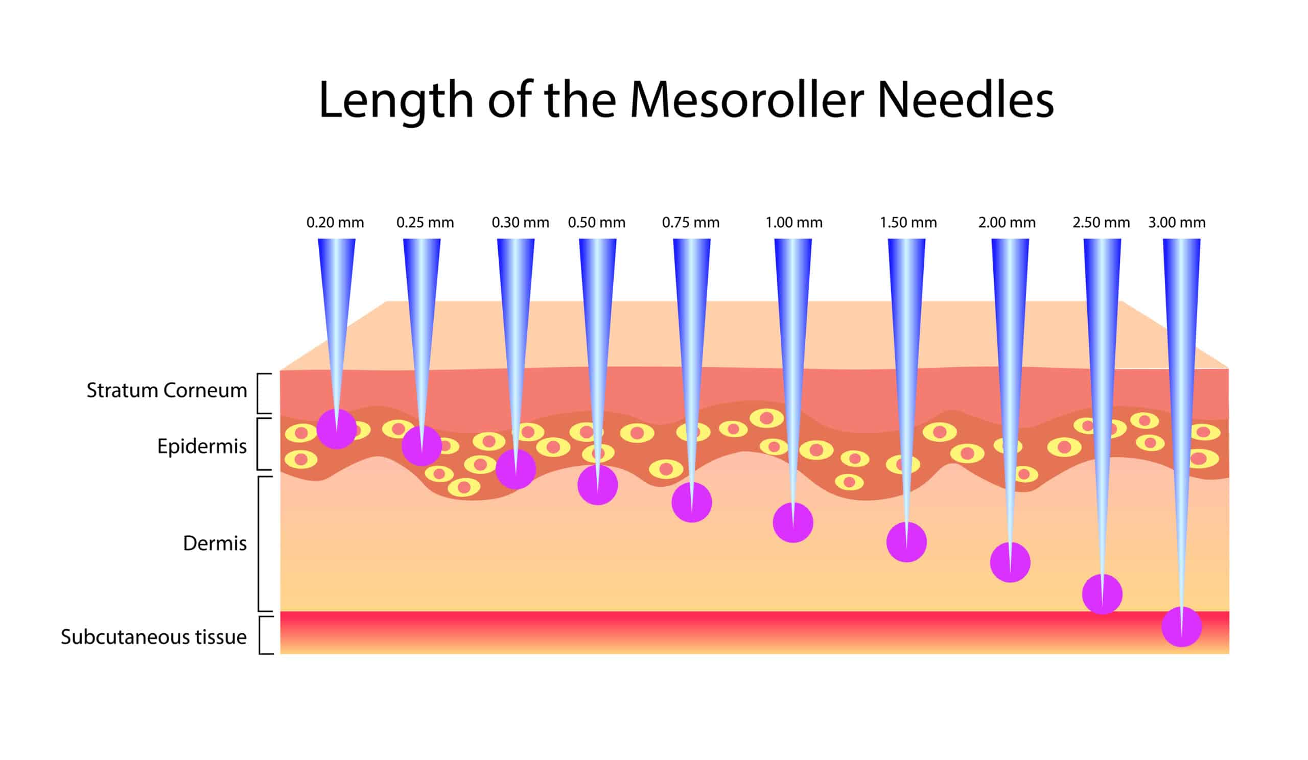 dermaroller skin penetration illustration