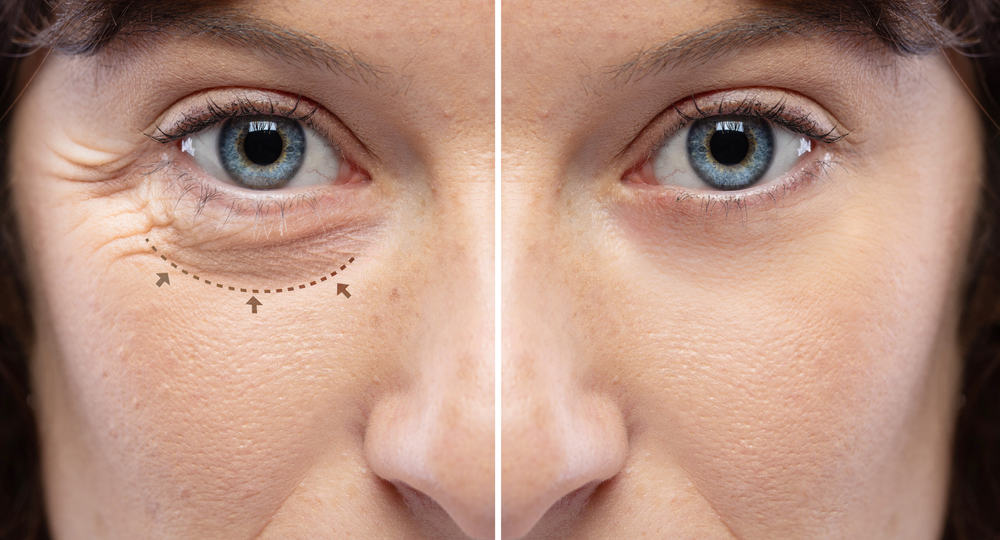 how-to-make-your-eyes-look-smaller-with-without-makeup