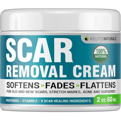 Kelly’s Naturals Scar Removal Cream