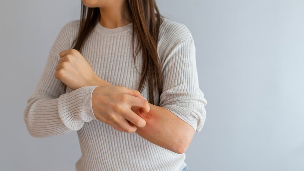 woman scratching itchy patchy skin